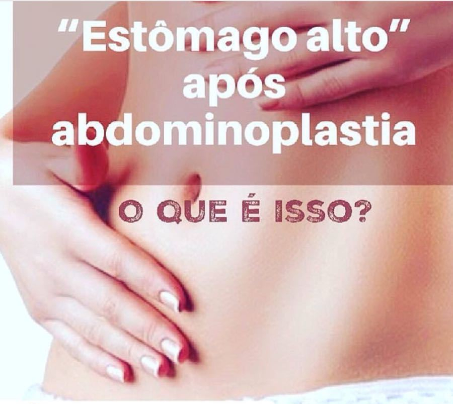 Uma queixa entre muitos pacientes no pós operatório tardio de abdominoplastia é o “estômago alto”.